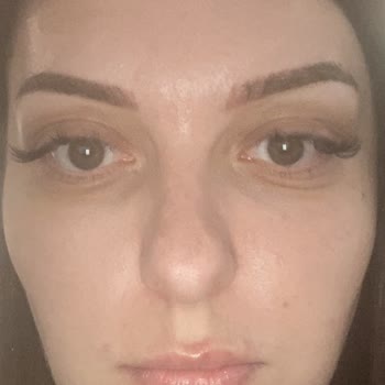 Kaş Microblading’inde Tek Kaş Pigment Tutmamış, Çözüm Ve İade Talebi