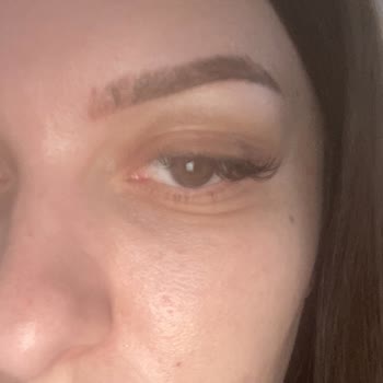Kaş Microblading’inde Tek Kaş Pigment Tutmamış, Çözüm Ve İade Talebi