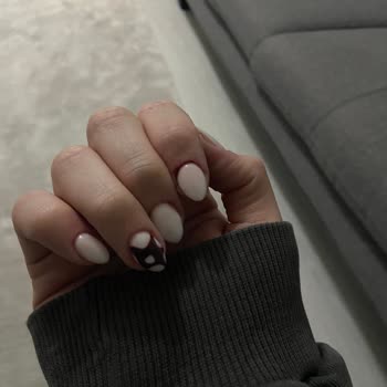 Randevu Gecikmesi, Yanlış Nail Art Ve Tırnak Yaralanmasıyla Aşırı Ücret