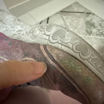 Skechers Ayakkabısındaki Erime Ve Yırtılma Sorunu Garanti Reddiyle Sonuçlandı