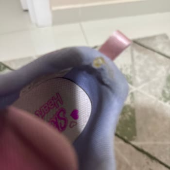Skechers Ayakkabısındaki Erime Ve Yırtılma Sorunu Garanti Reddiyle Sonuçlandı
