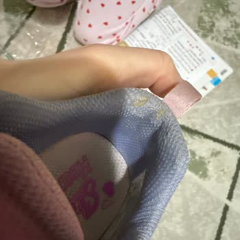 Skechers Ayakkabısındaki Erime Ve Yırtılma Sorunu Garanti Reddiyle Sonuçlandı