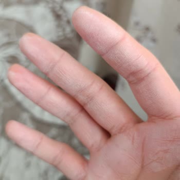 Bioderma Photoderm Kremi Cilde Nüfuz Etmiyor Ve Pul Dökülüyor