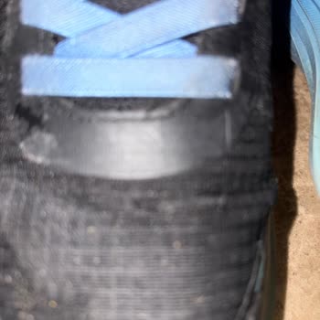 Skechers Ayakkabılarda Kısa Sürede Ön Bölüm Deformasyonu Ve İade Talebi