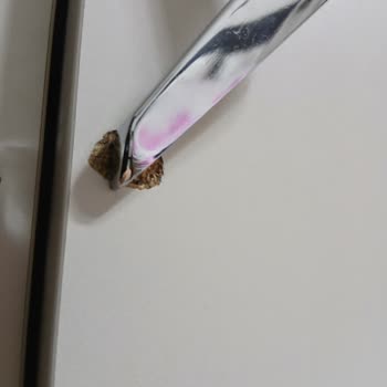 Gardırobun Kırık Parçaları Ve Kurulum Hatası İçin Çözüm Talebi