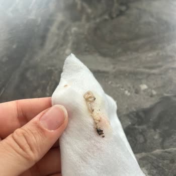 Kelle Paça Çorbasında Damar Parçaları Ve Yabancı Kıl Bulundu