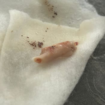 Kelle Paça Çorbasında Damar Parçaları Ve Yabancı Kıl Bulundu