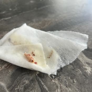 Kelle Paça Çorbasında Damar Parçaları Ve Yabancı Kıl Bulundu