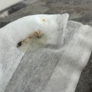 Kelle Paça Çorbasında Damar Parçaları Ve Yabancı Kıl Bulundu