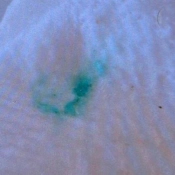 Güçlü Altın Konya Maddi Ve Manevi Olarak Zarara Uğradığımı Düşünüyorum