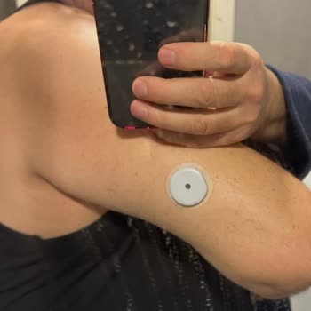 Roche Yeni Accu-Check Cihazı Bağlantı Kopması Ve Destek Yokluğu