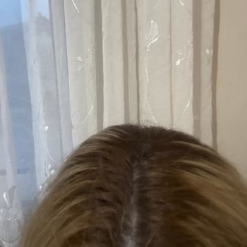 7.000 TL Ücretli Ombre İşlemi Sonucu Saç Rengi Kötü Çıktı, Psikolojik Ve Fiziksel Mağduriyet