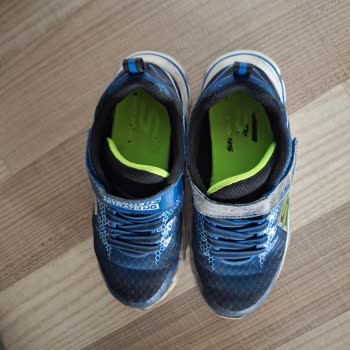 Skechers Çocuk Ayakkabısında Bir Ay İçinde Cırt Kısmının Deformasyonu Ve Kalite Sorunu