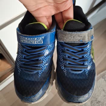 Skechers Çocuk Ayakkabısında Bir Ay İçinde Cırt Kısmının Deformasyonu Ve Kalite Sorunu