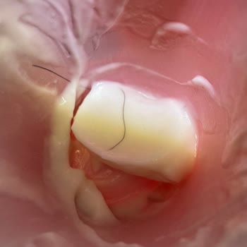 Yoğurtta Kıl Parçası Bulundu Hijyen Sorunu