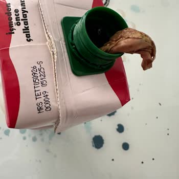 Cappy Vişne Suyu İçindeki Yabancı Cisim Ve Gıda Zehirlenmesi Şikayeti