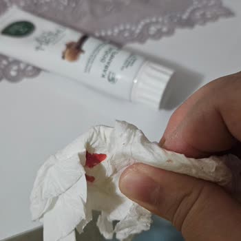 Keskin Ambalaj Folyosu Elimi Derin Kesti, Tasarım İncelemesi Ve Telafi Talebi