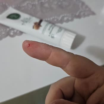 Keskin Ambalaj Folyosu Elimi Derin Kesti, Tasarım İncelemesi Ve Telafi Talebi