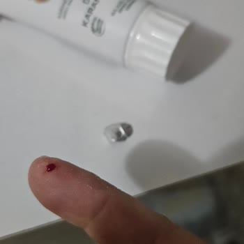 Keskin Ambalaj Folyosu Elimi Derin Kesti, Tasarım İncelemesi Ve Telafi Talebi