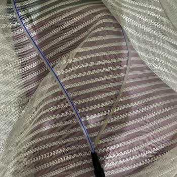 Beslenme Tüpü Sızıntısı Ve Hortumun Çıkması Nedeniyle Yaşanan Mağduriyet Ve Hastane İhmali