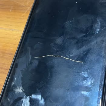 Ruffles Ketçaplı Cipste Boğazıma Gelen Yabancı Madde