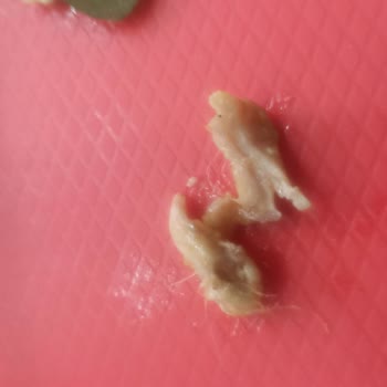 Zurna Dürümde Kıllı Tavuk Etleri Ve Hijyen Sorunu