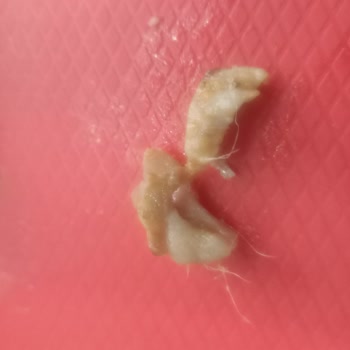 Zurna Dürümde Kıllı Tavuk Etleri Ve Hijyen Sorunu