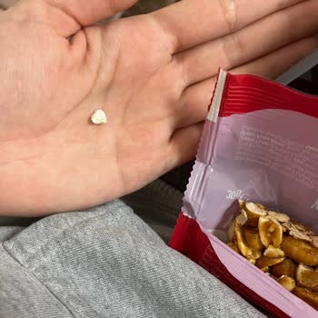 Simbat Yer Fıstıklı Krokan’da Plastik Parça Keşfi Ve Sağlık Riski