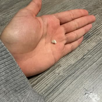 Simbat Yer Fıstıklı Krokan’da Plastik Parça Keşfi Ve Sağlık Riski