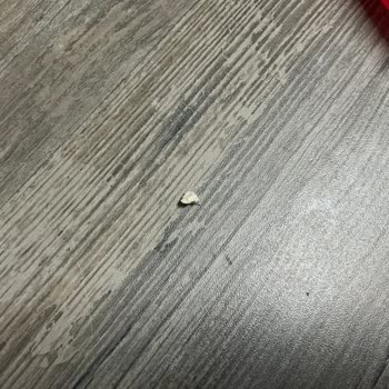 Simbat Yer Fıstıklı Krokan’da Plastik Parça Keşfi Ve Sağlık Riski