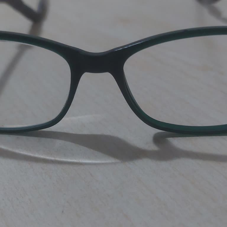 Garanti Kapsamındaki Gözlüğümün Kaybolan Lensinin Ücretsiz Değişimi Reddedildi