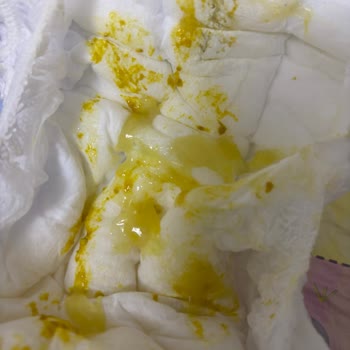 Evolvia Ac Mama Bebeğimde Aksine Etki: Şiddetli Gaz Ve Kabızlık