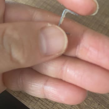 Kardeşler Pide Fırını Kayseri Peynirli Üründen Zımba Teli Çıkması