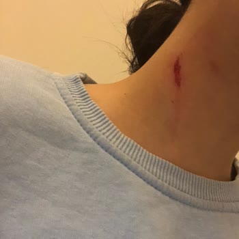 A101 Şubesinde Çalışanların Özensizliği Müşteriyi Yaraladı