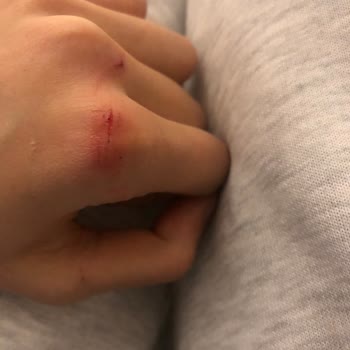 A101 Şubesinde Çalışanların Özensizliği Müşteriyi Yaraladı