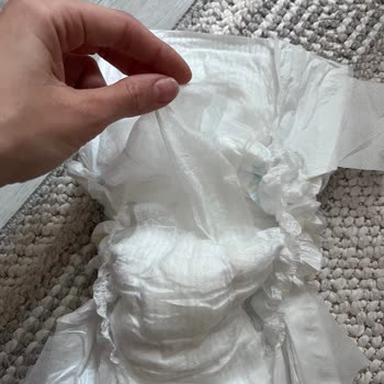 Molfix Bebek Bezinde İç Yapı Bozulması Ve Güvenlik Endişesi