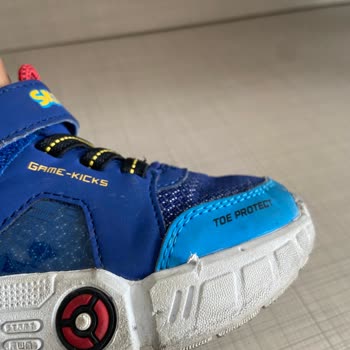 Garanti Kapsamındaki Deforme Olan Superkids Ayakkabısı İçin İade Ve Değişim Talebi