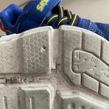 Garanti Kapsamındaki Deforme Olan Superkids Ayakkabısı İçin İade Ve Değişim Talebi