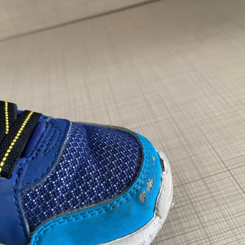 Garanti Kapsamındaki Deforme Olan Superkids Ayakkabısı İçin İade Ve Değişim Talebi