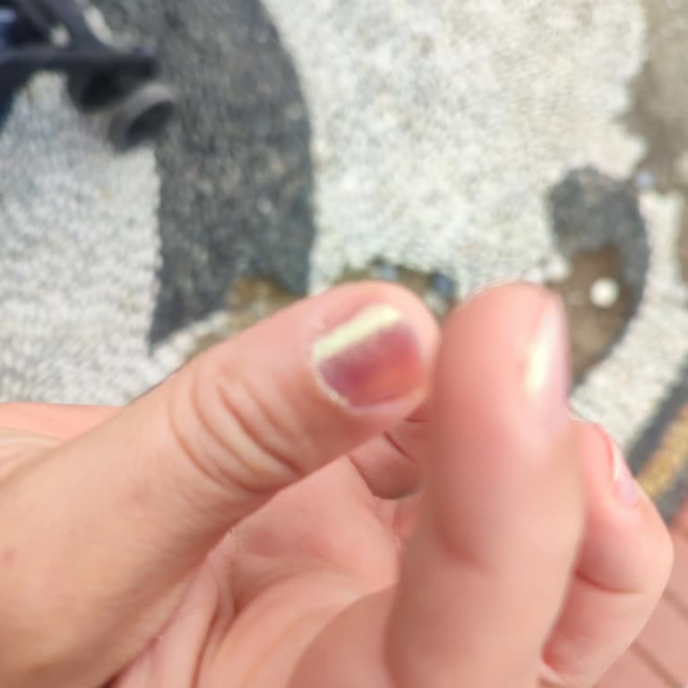 Alanya'daki İşletmede Hijyen Ve Ürün Kalitesi Sorunları Görmezden Gelindi