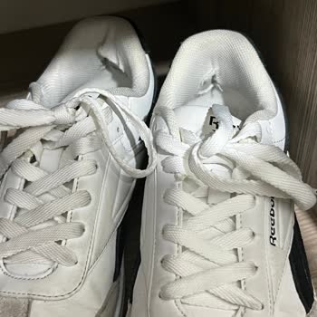 Ayakkabının Topuk Kısmı Ayrıldı, Mağaza İade Ve Değişim Talebini Reddetti