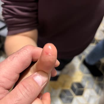 Migros Mağazasındaki Metal Çapak Çocuğumu Yaraladı, Yetkililer Sessiz