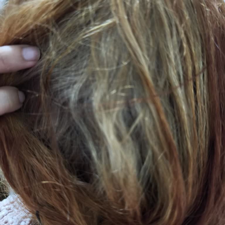 Malatya Ece Akademi Saçlarım Yandı!