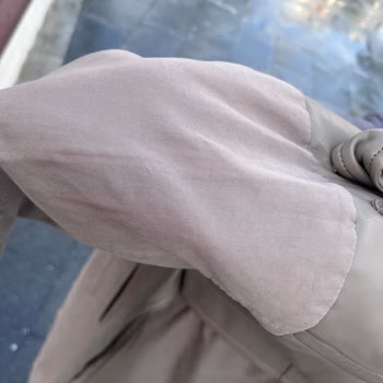 Hilltown İzmir Kuru Temizleme’de Trençkotta Düğme Deformasyonu Ve Montta Temizleme Eksikliği