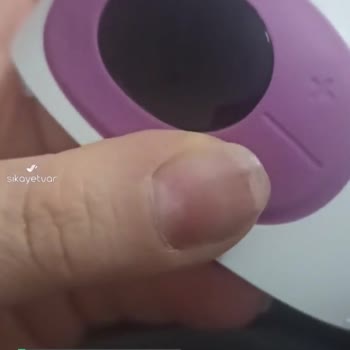 Mochi Çalışmıyor Işık Yok