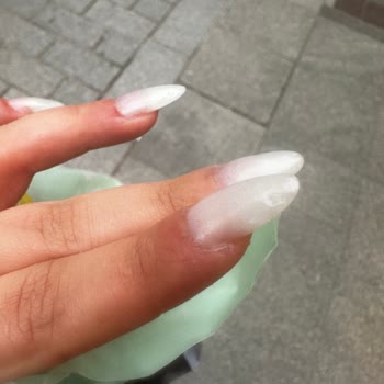 Yanlış Protez Tırnak Ve Kesilen Tırnak Etleri Nedeniyle Yaşadığım Ağrı Ve İade Talebi