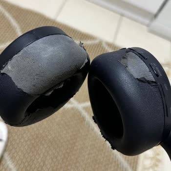 PlayStation 5 Kulaklığının Deri Dökülmesi Ve Çocukta Cilt Tahrişi