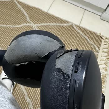 PlayStation 5 Kulaklığının Deri Dökülmesi Ve Çocukta Cilt Tahrişi