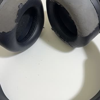 PlayStation 5 Kulaklığının Deri Dökülmesi Ve Çocukta Cilt Tahrişi