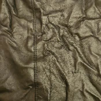 Deri Kısmı Pul Pulu Dökülen Elbise İçin Ürün Değişimi Ve İade Talebi